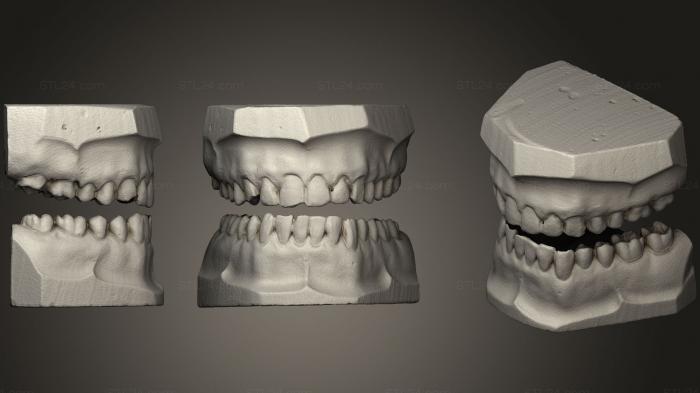 Анатомия скелеты и черепа (Гипсовые зубы, ANTM_0566) 3D модель для ЧПУ станка